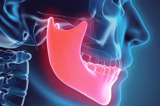 bruxism and tinnitus